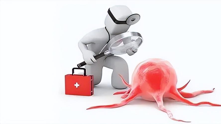 肿瘤|一名肿瘤医生患上多种癌症后依旧能活几十年！这些方面值得借鉴！