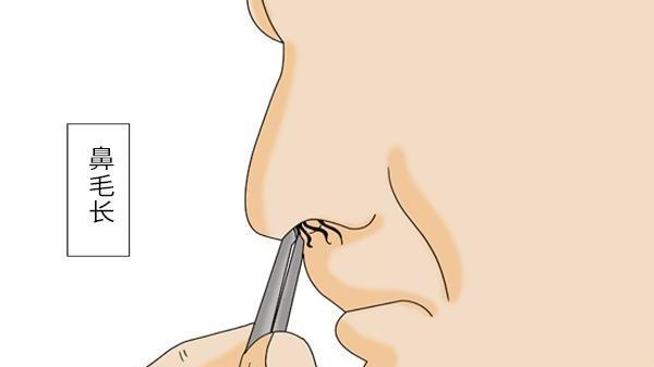 |人还没老，鼻毛先白，是身体加速衰老的意思？别慌，看医生咋说