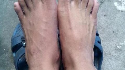 便秘|血管堵不堵，伸出脚看看就知道了，若有这表现，最好别忽略