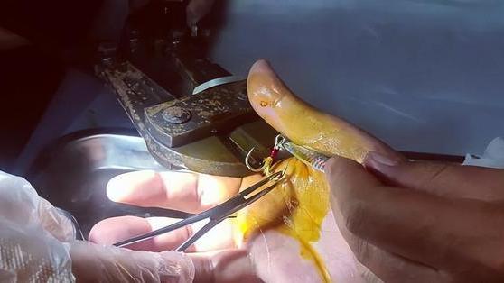 医院|广东一男子出名了，钓鱼反把自己送进了医院，到底是怎么回事？