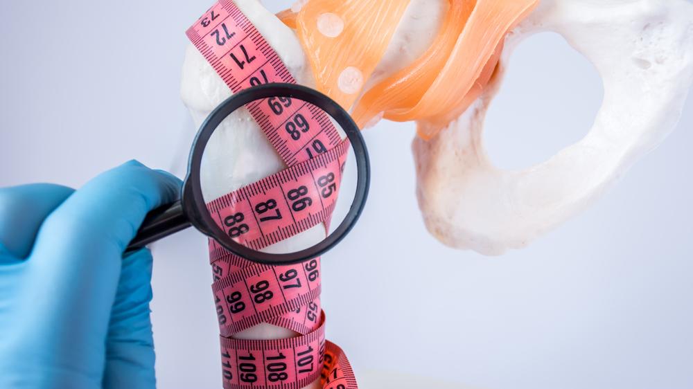 体检|73岁老人摔倒，髋骨骨折住进ICU！医生：不夸张！老人骨折胜过癌