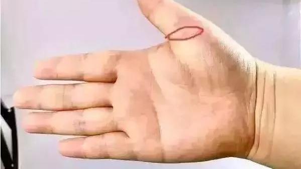 穴位|一个奇穴，治各种“不通”！