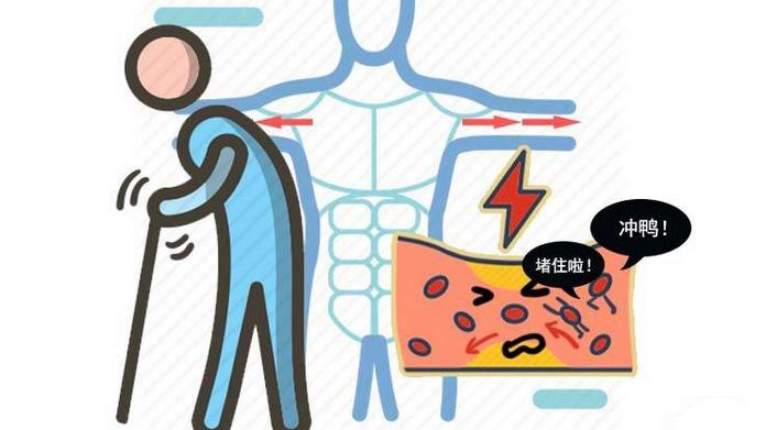 睡眠|睡觉睡出来的怪异，可得多个心眼，有可能是心血管暗示你