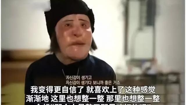 韩慧景|整容成瘾韩慧景：把脸整得面目全非，给自己注射机油，后悔莫及
