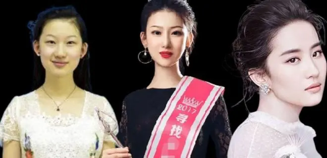 刘亦菲|多年前一个19岁少女花费百万整容，以刘亦菲为模板要求一模一样，如今好吗？