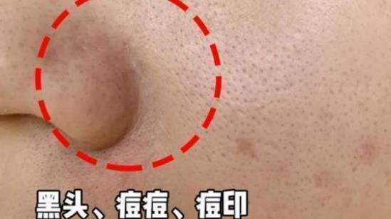 西兰花|爽肤水这样抹等于白用！来看看正确使用方法吧！