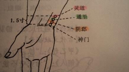 穴位|通里穴，治中风失语！