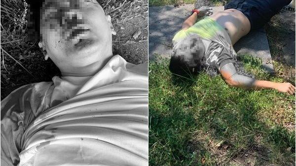 林志颖|林志颖驾驶特斯拉发生严重车祸，现已送医