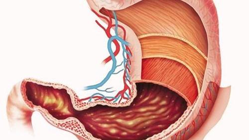 胃癌|为何“胃病”越来越多？提醒你，这4类“伤胃”食物，少吃