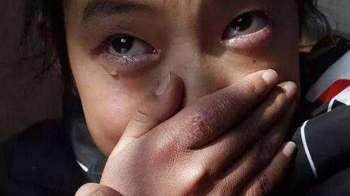 肾病综合征|女孩腹痛，误诊胃肠炎治疗无效，妇科医生：无孔，只能造个新的！