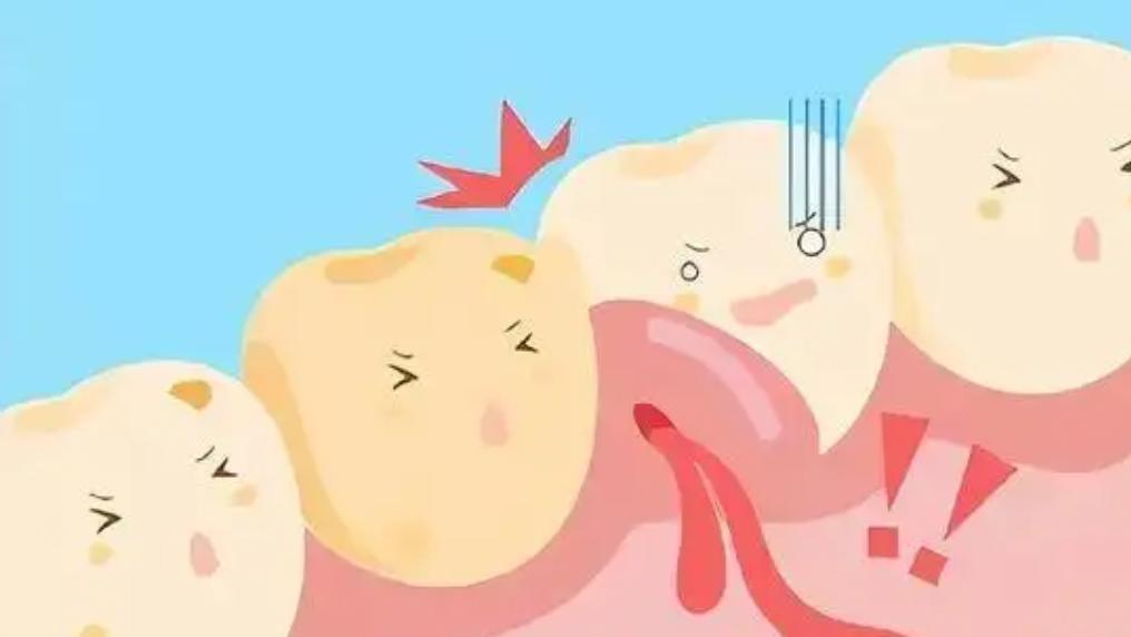 |牙周脓肿怎么预防?