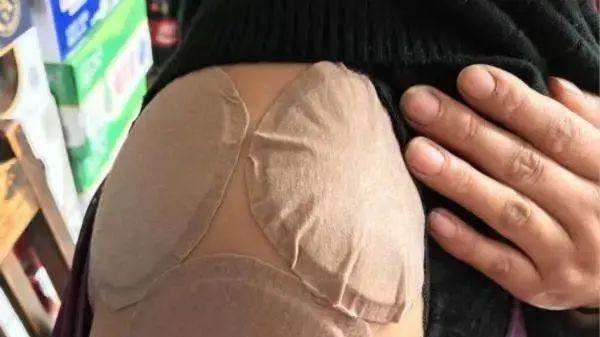 肩周炎|三年肩周炎，她体验到了“给自己上刑”的滋味！