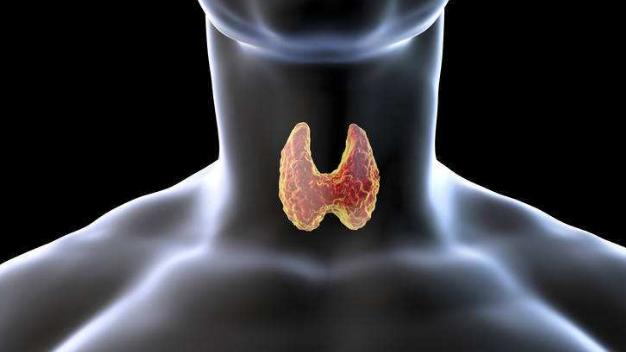 甲状腺癌|脖子出现这2个信号，可能是甲状腺癌发出的“信号”，别忽视了