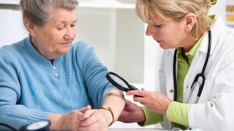 肝脏|身上长红痣，就是肝病的标志？肝开始病变时，手脚可能有4种迹象