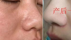 护肤品 孕期你知道如何选护肤品吗？超实用精简护肤方法出炉，不看吃亏！