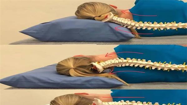 养生|颈椎前倾怎么办？发现问题及时调治