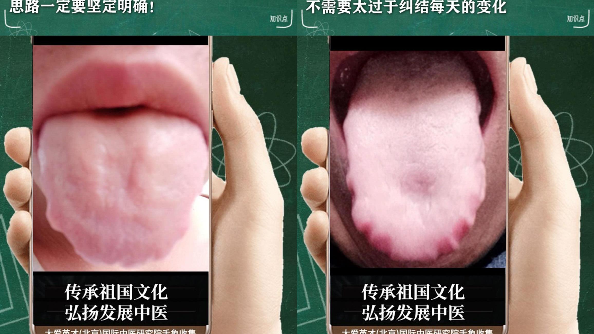 奥美拉唑|中医病症：易压抑、易于感冒、内湿痰多、反反复复很难过