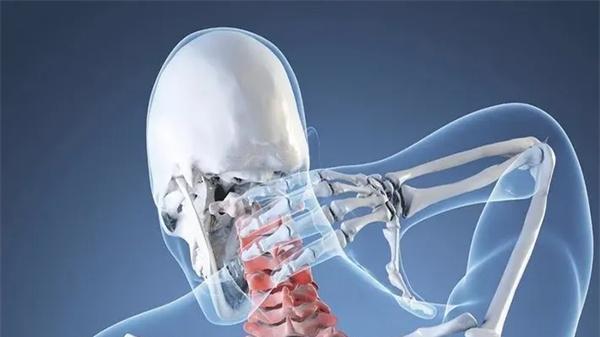 医生|颈椎病还会手麻？有可能是神经根受压