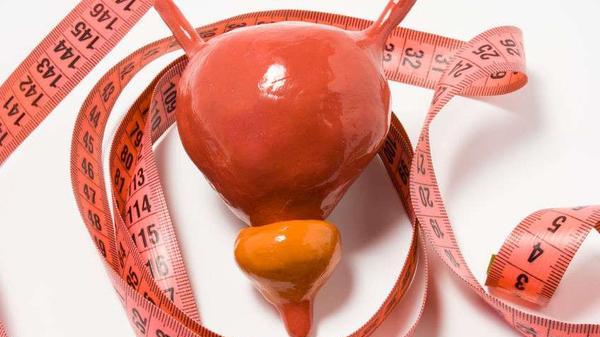 膀胱癌|排尿时有4种表现，当心膀胱癌找上门，尤其是这4类人，要警惕