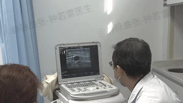 大脑|【静脉曲张案例9】老年人静脉曲张血管发黑，儿子不忍放弃带母求医