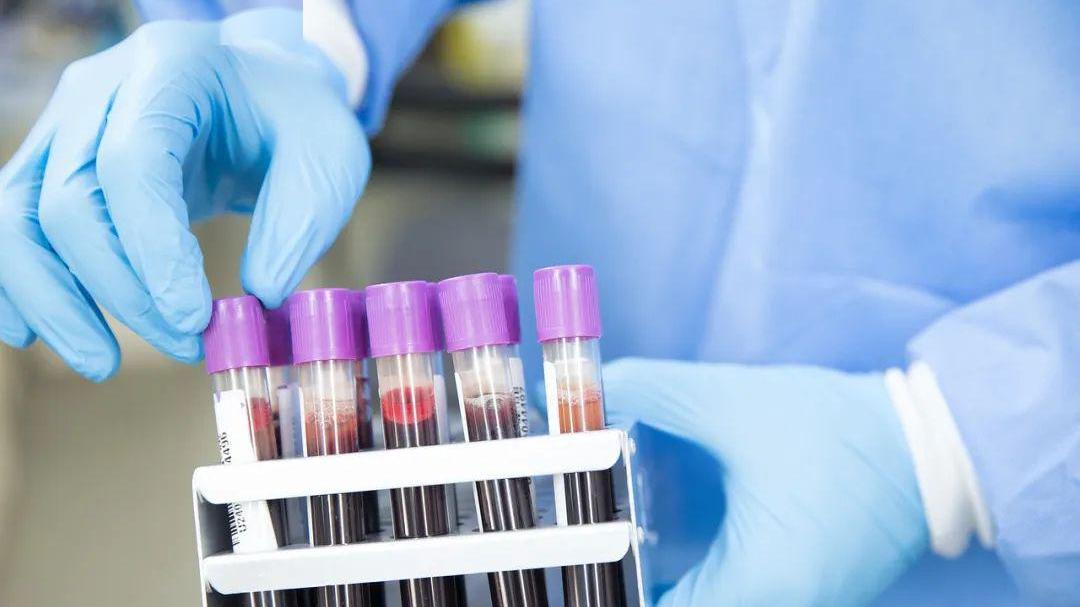 肝脏|肝纤维化是肝炎发展来的？肝纤维化还能恢复正常吗？多久到肝硬化