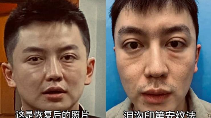 整容|网红金大威：哭诉整容失败史，小鲜肉变沧桑大叔，到底是谁害了他