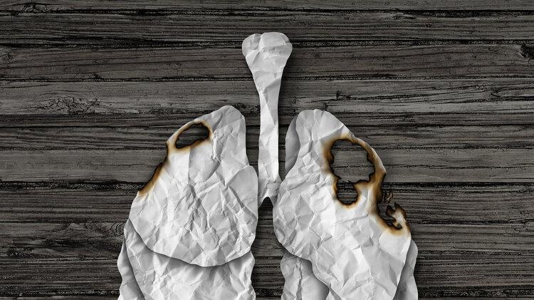 肺癌|肺部有癌，睡眠先知？睡觉时若有这4种迹象，或是肺癌来临的预警