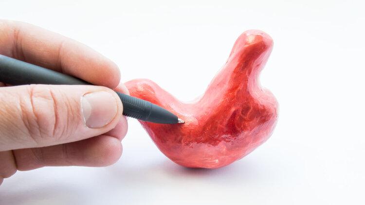 胃癌|眼睁睁看着岳父患癌离世，肿瘤专家的2个反思，发人深省