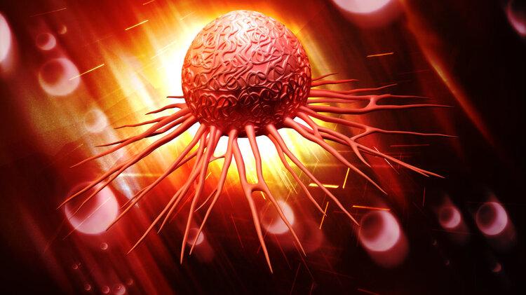 癌细胞|高温烫死癌细胞，证实有效，腹腔热灌注化疗可治多种肿瘤，损伤小