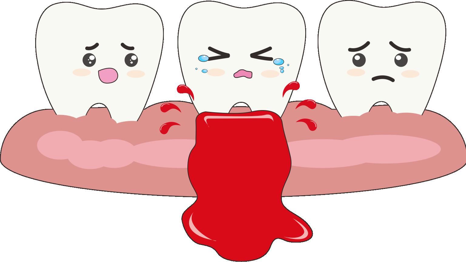 肾虚|你知道吗，每日清洁牙缝，牙龈出血率降低近40%