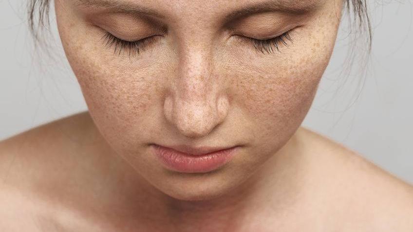 防晒|脸上长斑，或与这4个诱发因素有关，要避开，才能有效预防斑点