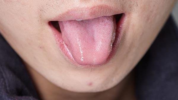 |舌头开裂、有齿痕，可能是几个问题所引起的，不能大意
