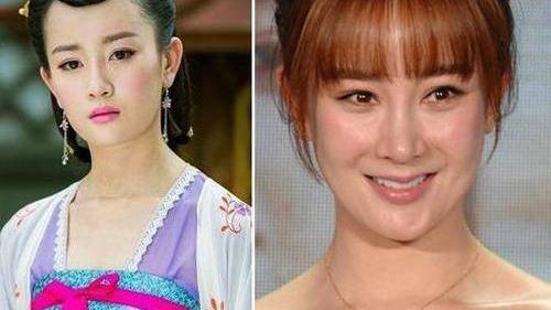 王心凌|“被玻尿酸毁容”的六大女星，王心凌像老太婆，她却让人无法接受