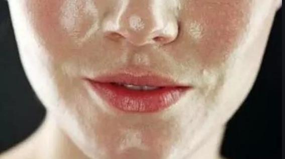 营收 皮肤类型，你属于哪种呢