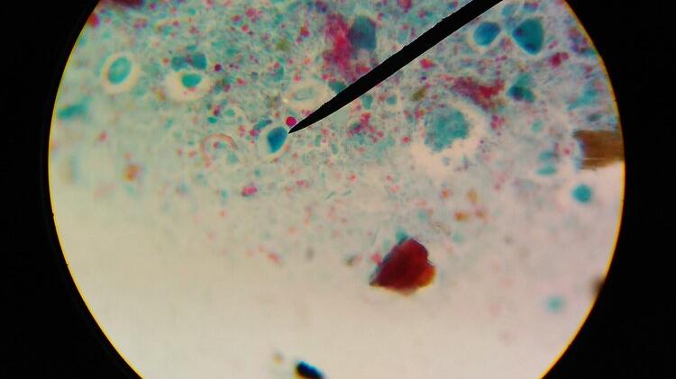 火锅|再次提醒：5种食物是寄生虫的“重灾区”，宁愿不吃，也要少碰