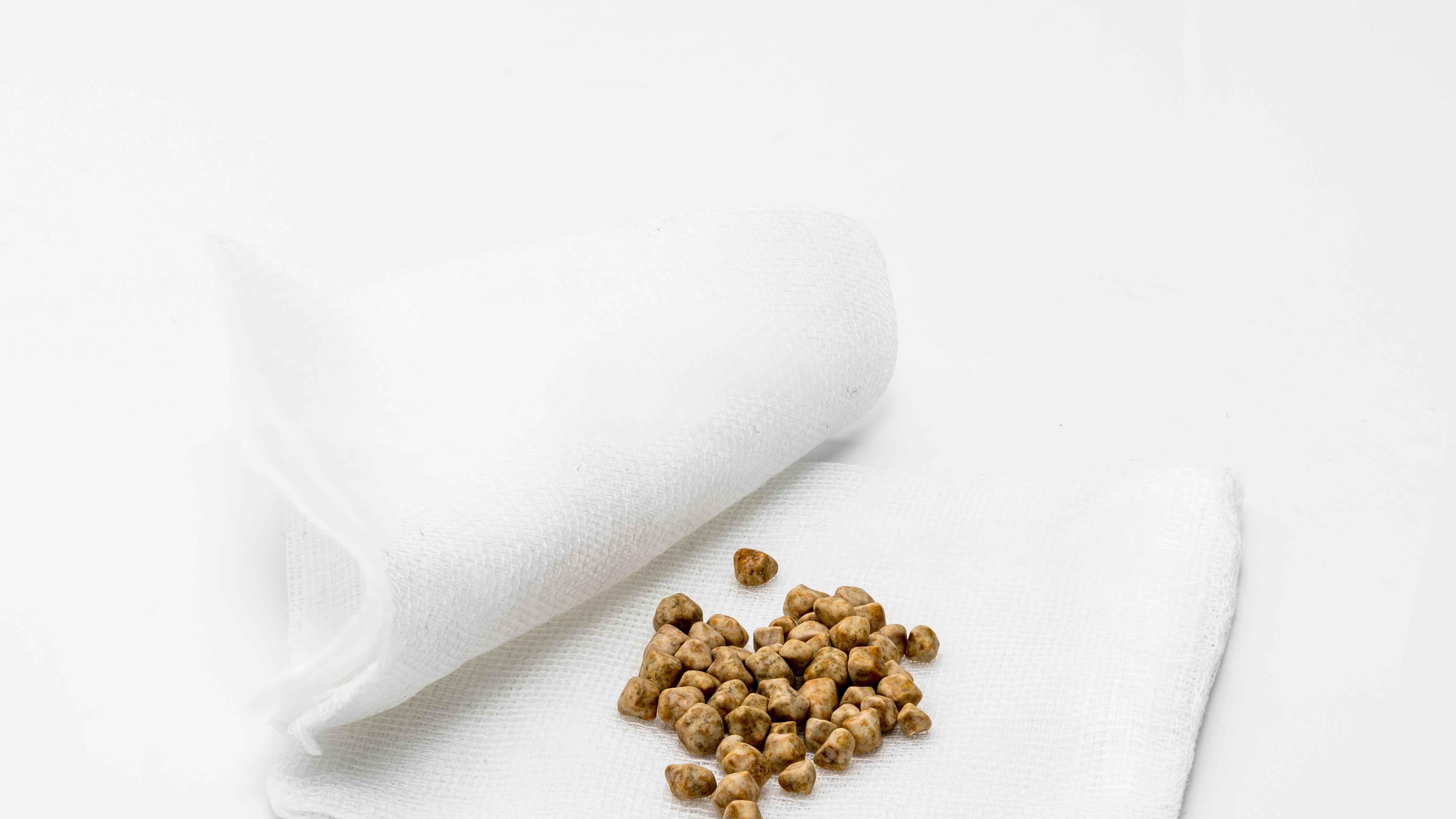 咳嗽|结石让你痛苦不堪？提醒：多半是这4个习惯惹的祸，日常需远离！