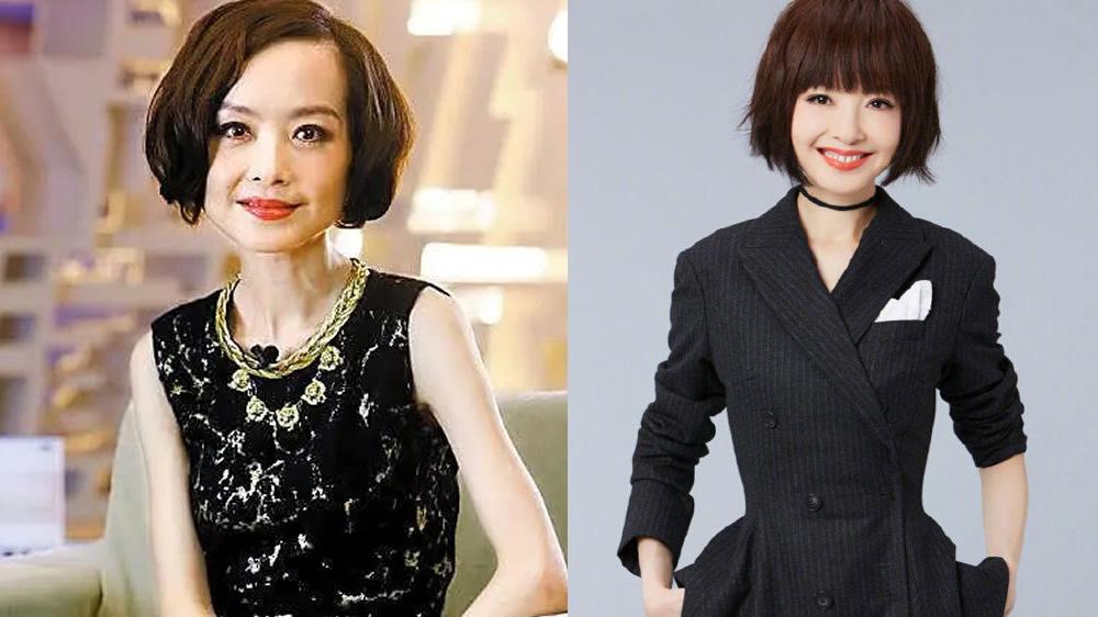 发际线 发际线高显老又土气，用了这些小办法，可以拯救发际线.