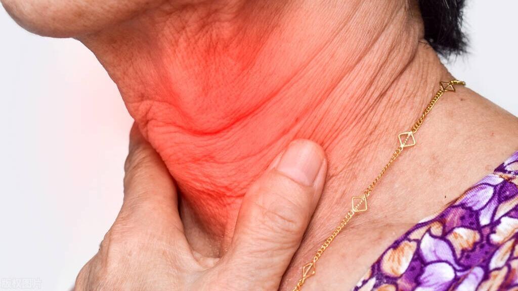 饮食|甲减给身体带来的伤害，你万万想不到，饮食调理需注意四个问题