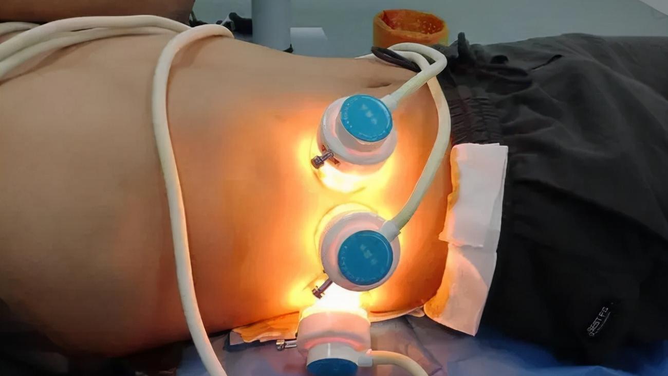 任何部位的白癜风都可以做黑色素种植吗？术后要怎么护理呢？