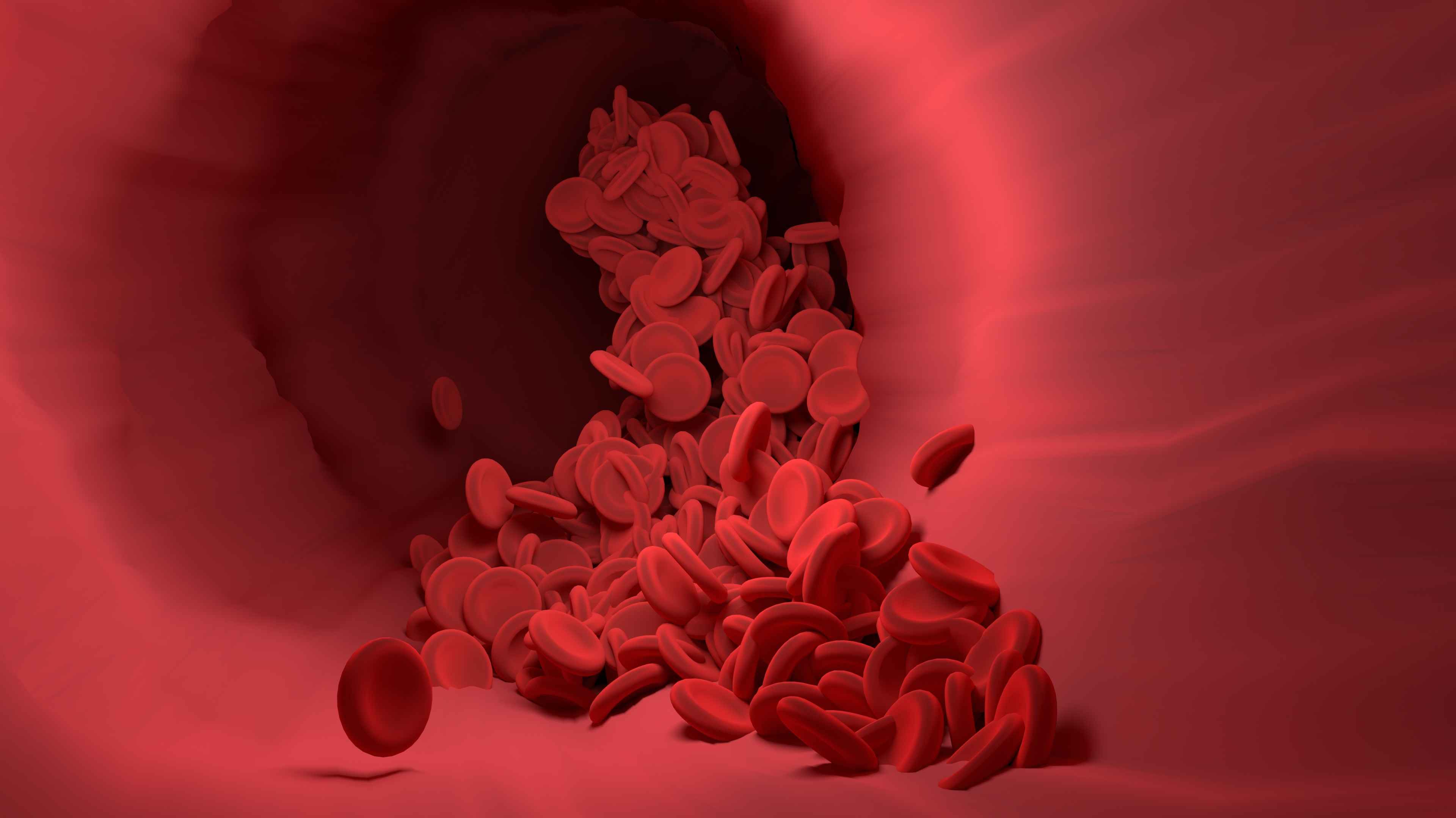 血栓|查出血液粘稠，生活中要做好这6件事，或可改善血液粘稠的问题