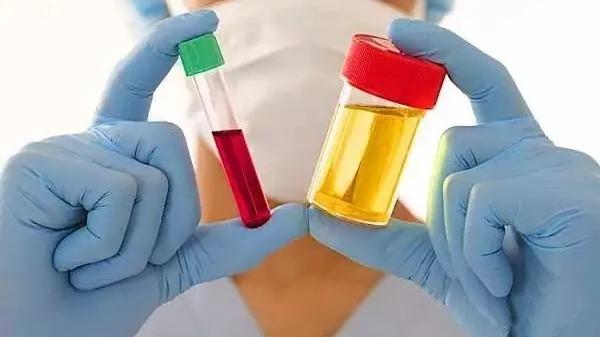 医生|痛风|为什么医生总强调要定期复查，复查的意义到底是什么？