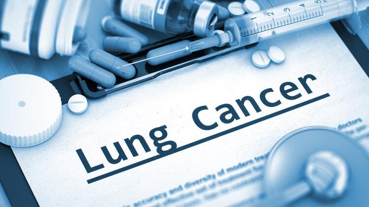 咳嗽|72岁肿瘤专家患癌，抗癌一年离世，他的2个后悔，要引以为戒