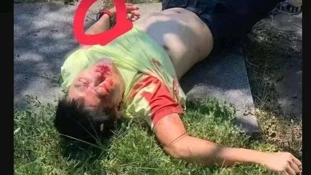 成毅|林志颖伤情：目前人已清醒，面部和肩膀骨折需要手术