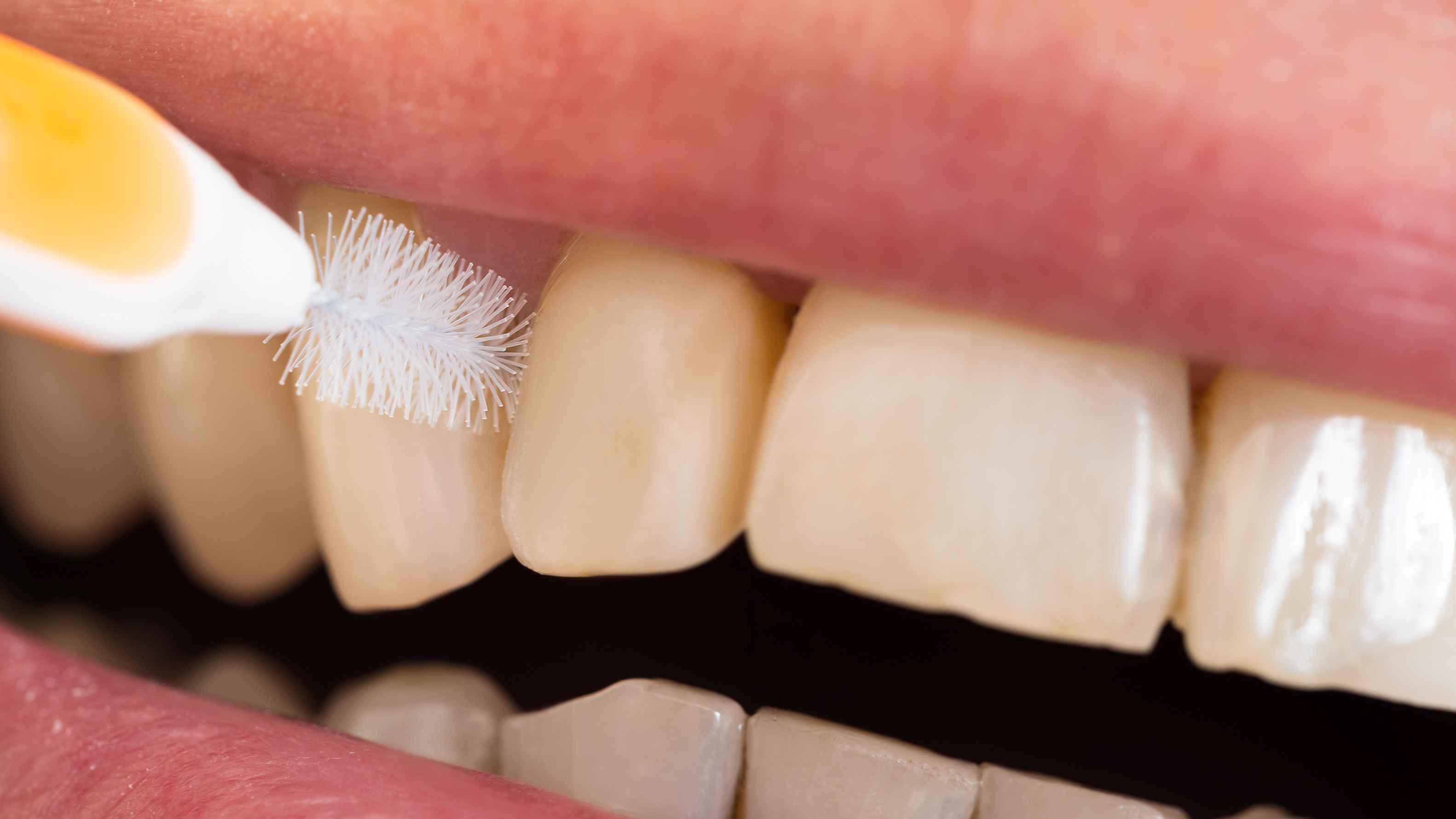 肝脏|不刷牙会增加死亡风险？刷牙若能做好5步，至少战胜了一半的成人