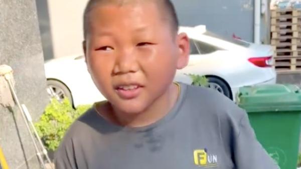 长春|27岁小伙长娃娃脸找工作成难题：劝他去当演员，你只是为了编排他