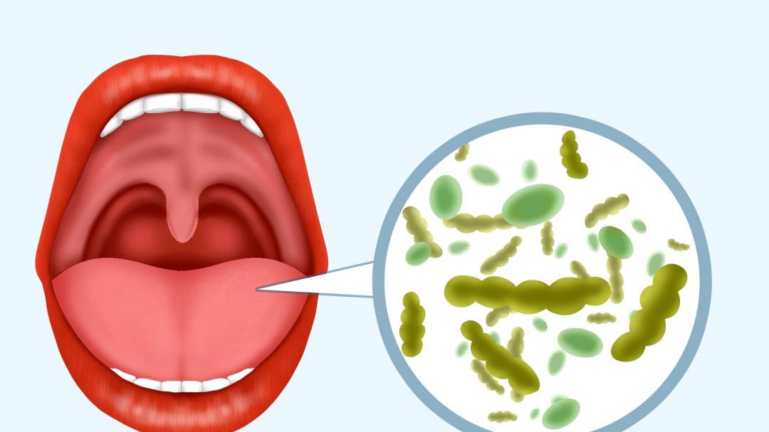 大米|口苦是肝火，口臭是胃火，家中常备5个中成药，五脏有火不愁人
