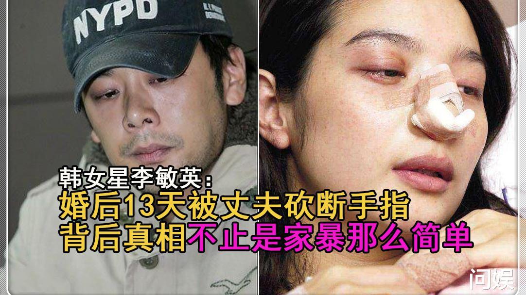 李敏英|女星李敏英婚后13天被丈夫砍断手指，背后真相不止是家暴那么简单