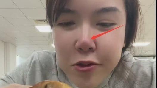 浪胃仙|网红浪胃仙被曝整容，鼻子红肿面部惊悚，下巴酷似蛇精脸