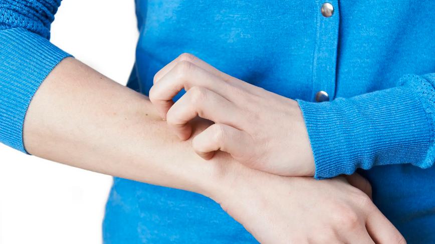 |皮肤异常瘙痒，可能是大病的信号，不要大意了！