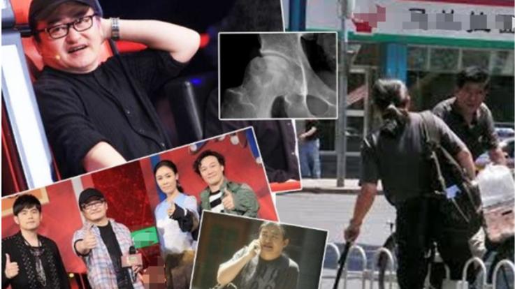 刘欢|58岁刘欢满脸憔悴，52岁孙楠瘦到不敢认，人到50岁是一道坎吗？